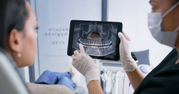 Licensed Tooth Extraction service in Claremont, CA - Smile Center Dentistry