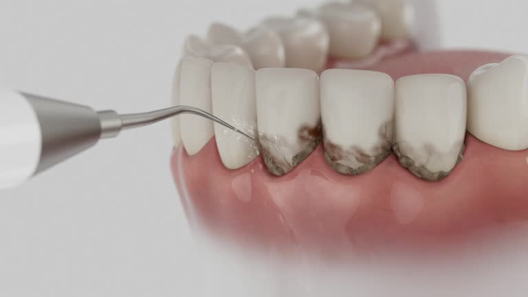 Reliable Tooth Extraction contractor in Claremont, CA by Smile Center Dentistry